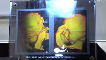 هولوگرام جنین